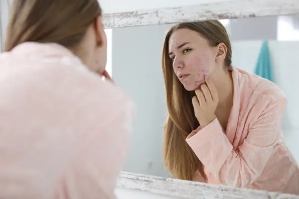 Skin Conditions