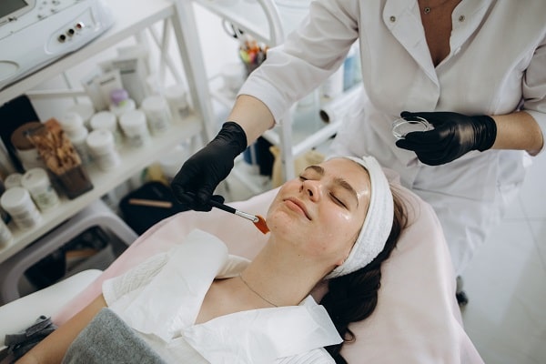 Chemical Peel London