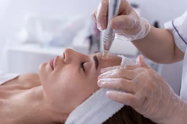 Dermapen Treatment London