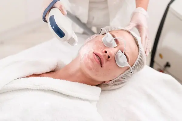 acne treatment london