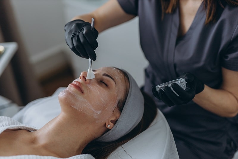 chemical peel treatment in london